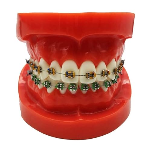 FHUILI Dental KFO-Demonstrationsmodell - Dental Teeth Studie Lehre Modell - Typodont Zähne Modell mit Mental Brackets - Simulation Oral Zahn KFO Zähne Modell mit Ligatur Krawatten,S von FHUILI