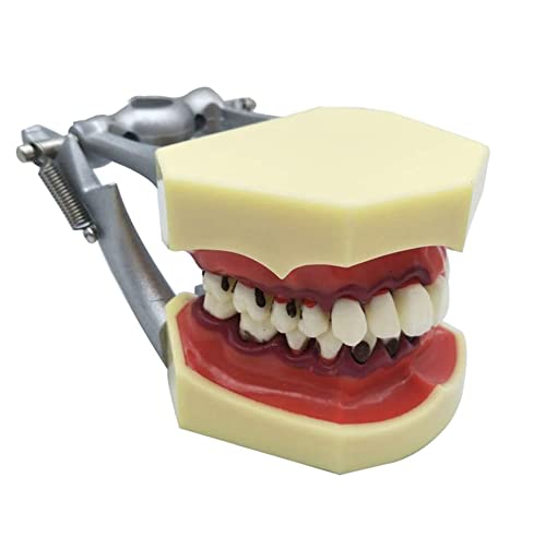 FHUILI Dental Teeth Studie Lehre Modell - Parodontose ASSORT Zähne Gums Zahnpflege Lehre Studienmodell - Simulation Oral Zahn Typodont Zähne Modell - für das Studium Lehr Anzeige,A von FHUILI