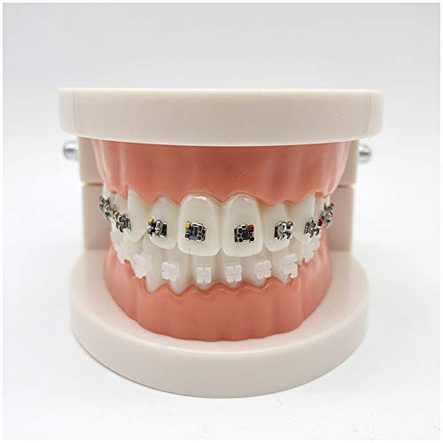 FHUILI Simulation Oral Tooth - Dental KFO-Demonstrationsmodell - Dental Teeth Studie Lehre Modell - Behandlung Modell mit Metallhalterung, Bogen Draht Erklären Modell mit Klammern,A von FHUILI