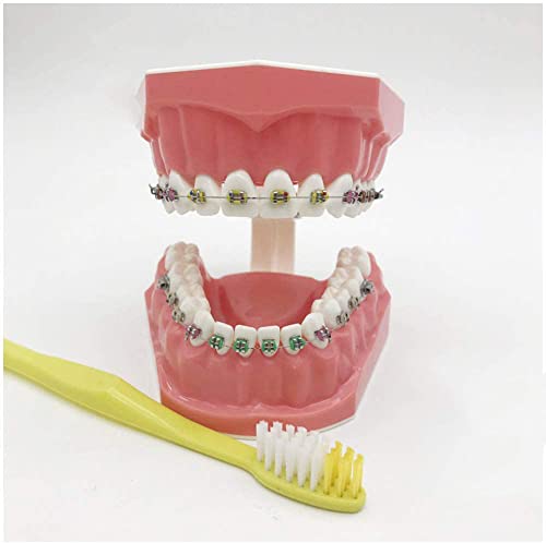 FHUILI Zähne Modell für Ausbildung - KFO-Modell - Zähne Lehr-Modell mit Metall und Keramik Bracket - Zähne Modell Korrektive Trainingsmodell für Kinder Oral Care Lehre,A von FHUILI