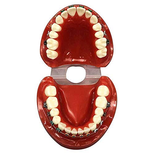 FHUILI Zähne Teaching Model - KFO Zähne Modell - Zähne Vorführmodell - Dental Typodont mit Mental Brackets KFO Zähne Modell mit Ligatur Krawatten Red,A von FHUILI