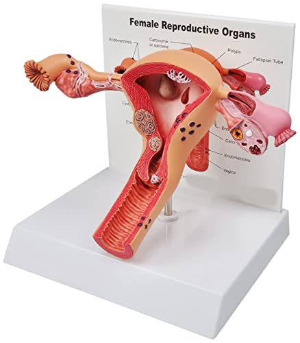 UIGJIOG Human Uterus Model Sick Uterus Modell Uterus-Eierstock Modell Weibliche Reproduktion der Organe Anatomisches Modell von UIGJIOG