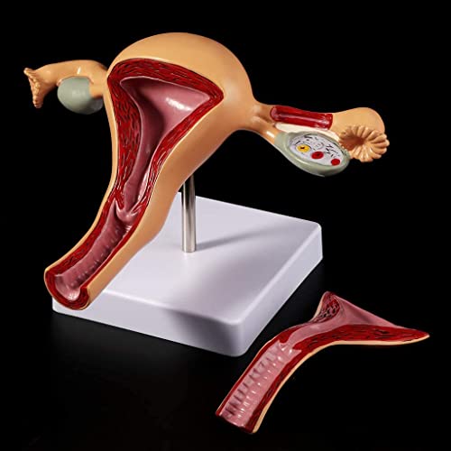 UIGJIOG Weibliches Modell des Uterus-Eierstocks, Von Der Weiblichen Inneren Wiedergabemodell des Menschlichen Pathologischen Gebärmutters, Anatomischer Anatomie, Pathologie von UIGJIOG